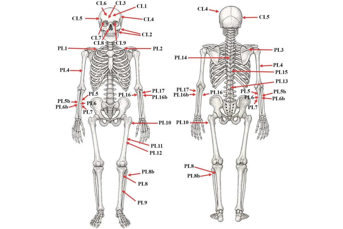 Gyilkosság hidegvérrel?  Az Árpád-házi Macsói Béla herceg igazságügyi és biorégészeti azonosítása